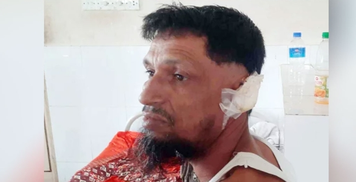 স্ত্রীর কামড়ে স্বামীর অঙ্গ বিচ্ছিন্ন স্ত্রীর কামড়ে স্বামীর অঙ্গ বিচ্ছিন্ন