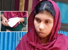 গৃহকর্মী আয়েশার হাতে ব্যান্ডেজ নিয়ে যা জানা গেল