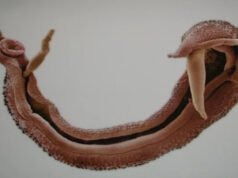 দ্রুত ছড়াচ্ছে যৌ’নাঙ্গ আক্রান্তকারী পরজীবী, বিজ্ঞানীদের সতর্কতা