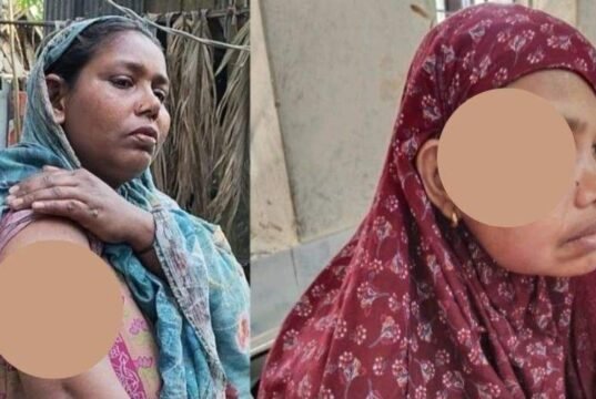 দাঁড়িপাল্লায় ভোট দেওয়ায় বিএনপি নেতার নেতৃত্বে তিন নারীকে পিটিয়ে জখম